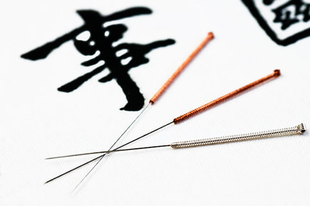 Acupuncture Bondi